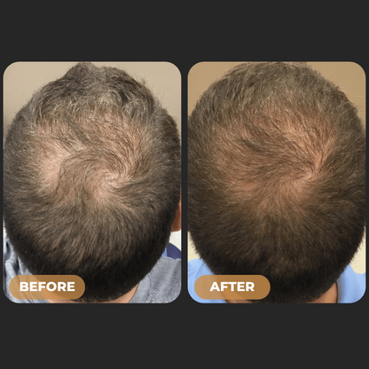 ODALIT™ Root Activator Shampoo - Increased Hair Growth with Just 4 Washes a Week*