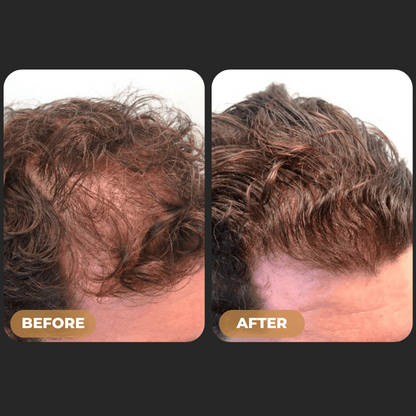 ODALIT™ Root Activator Shampoo - Increased Hair Growth with Just 4 Washes a Week*
